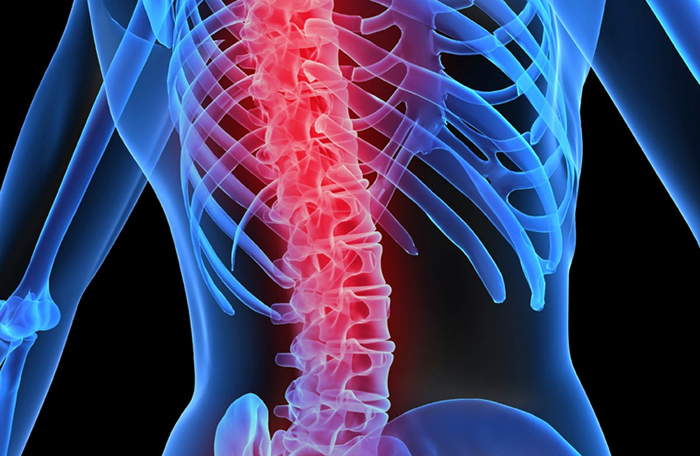 osteoporosis