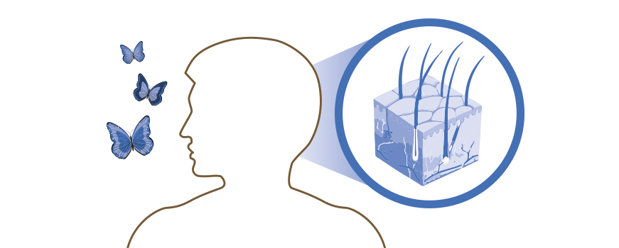 Prevención caída del cabello